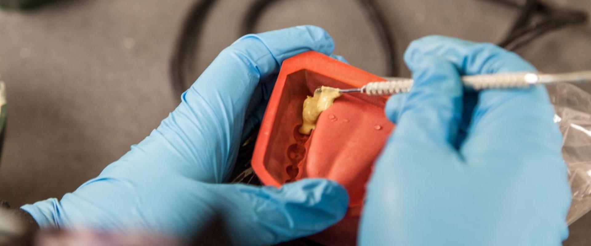 Gloved hands adding plaster to a dental mold