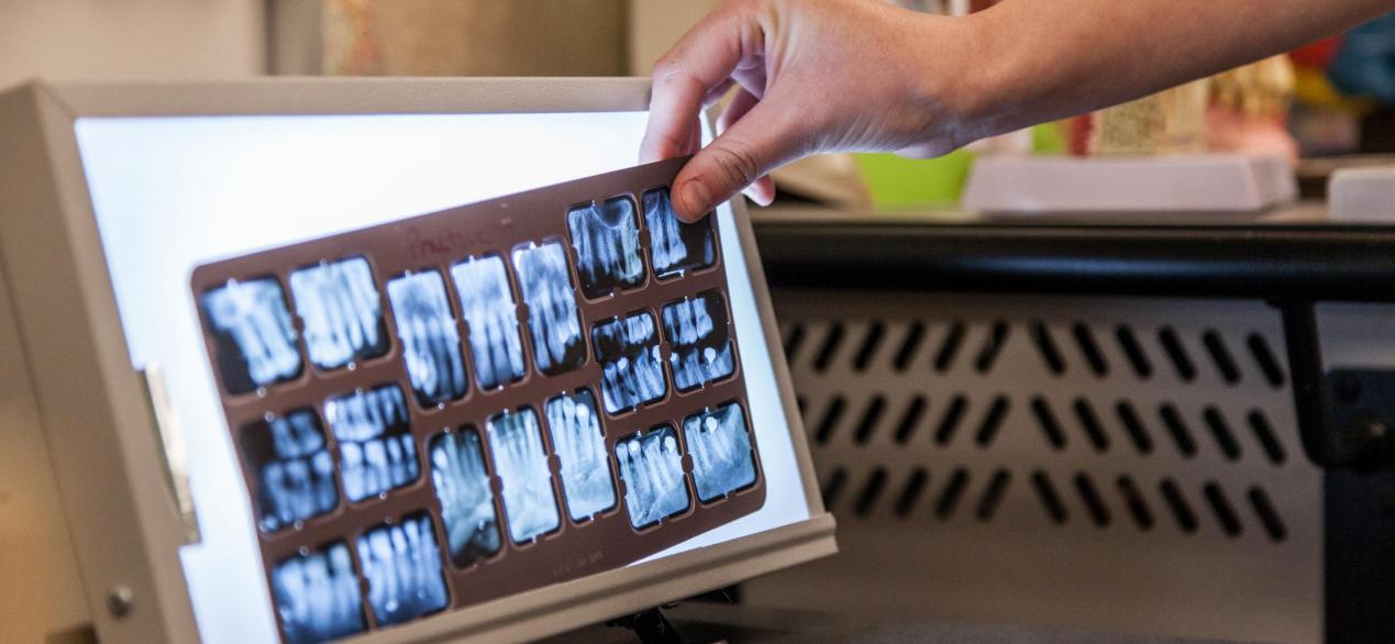 Image of dental X-rays on a light box